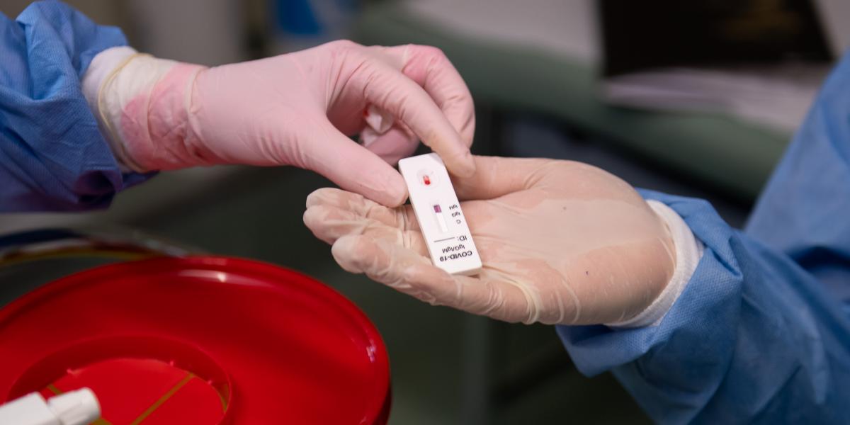 Teszt. Elkezdődött a nyár végi SARS–CoV–2-hullám