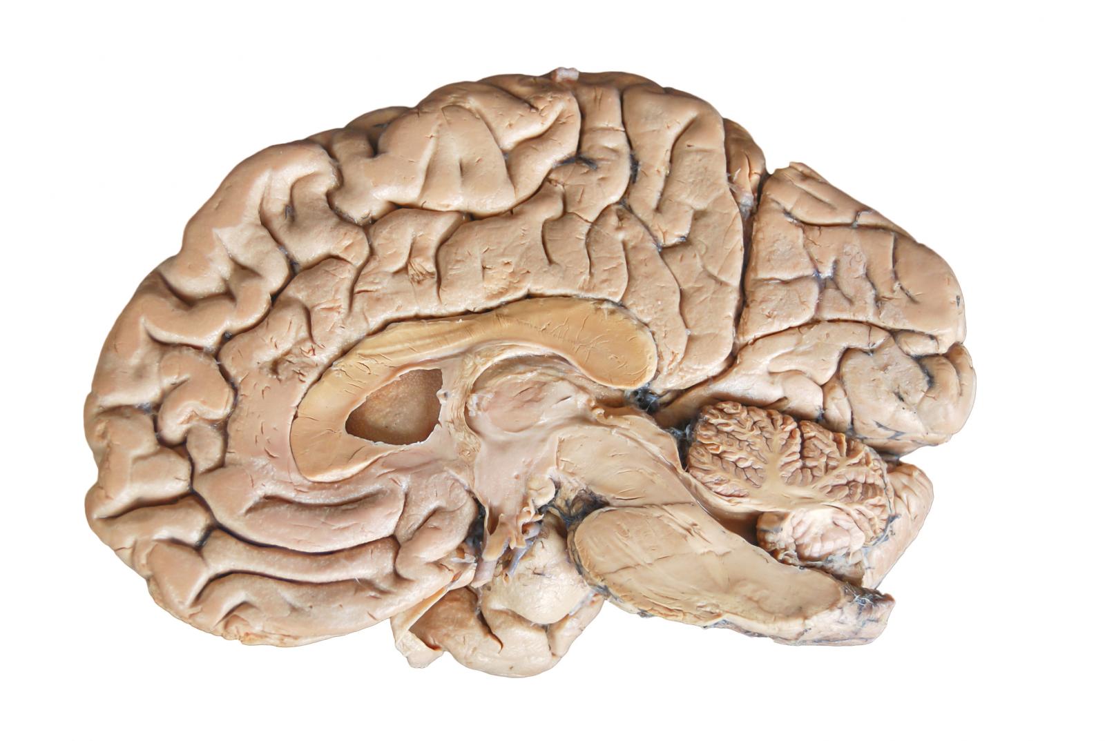 Az agy működése nagyon összetett és bonyolult