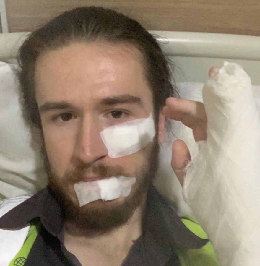 Mézes László Róbert száját és arcát két helyen összevarrták, két ujja is gipszben van.