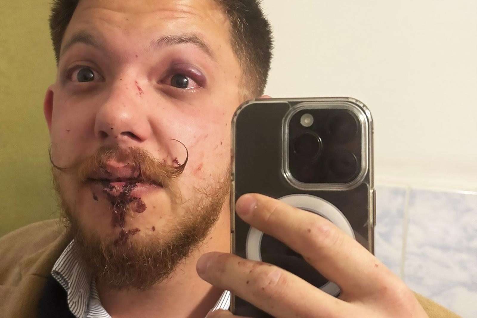 Azt skandálták a fiatalok, hogy „Árad a Tisza!”, véresre verték őket Sepsiszentgyörgyön