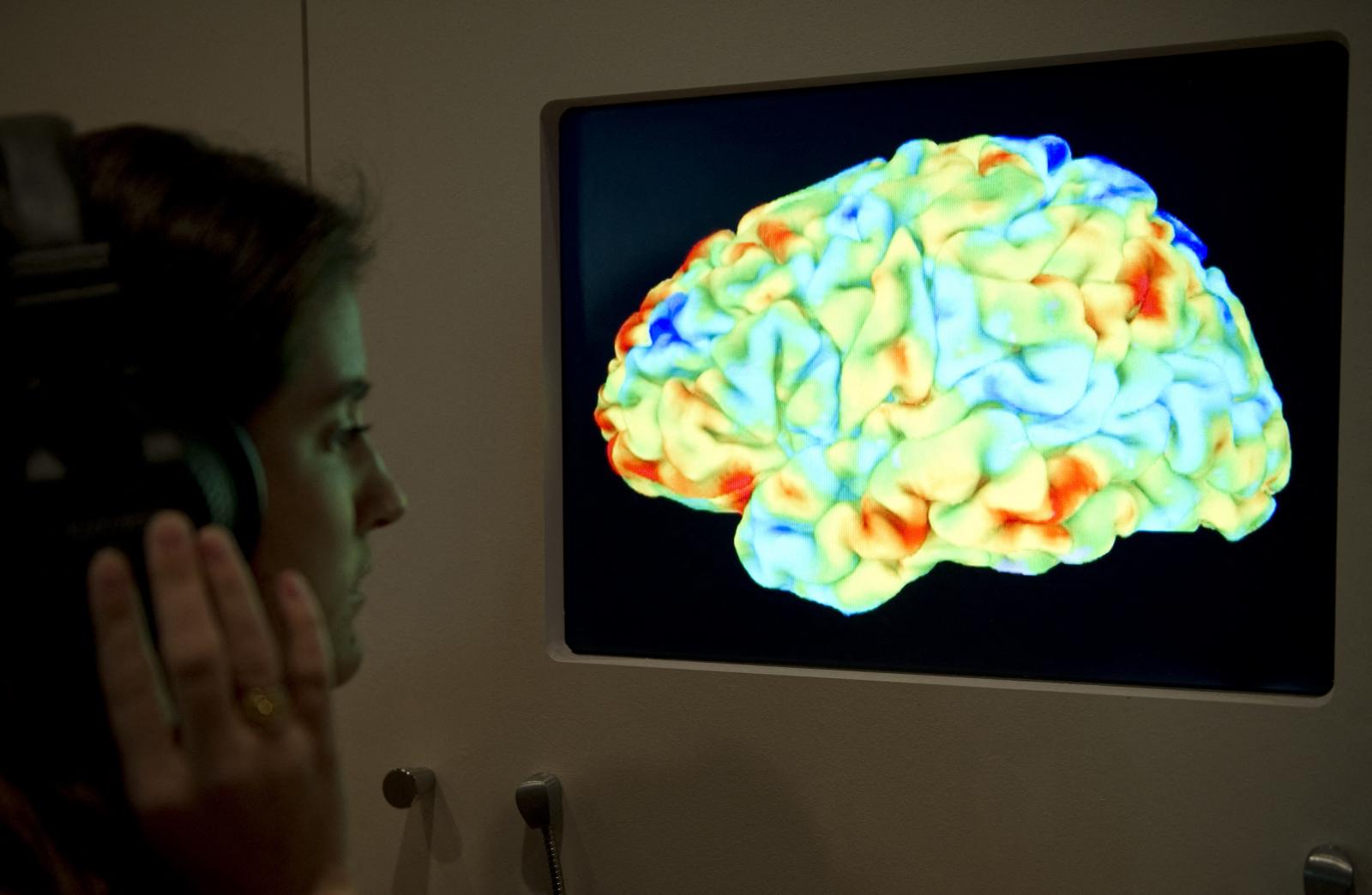 Az agyi képalkotó vizsgálatok egyike, az fMRI