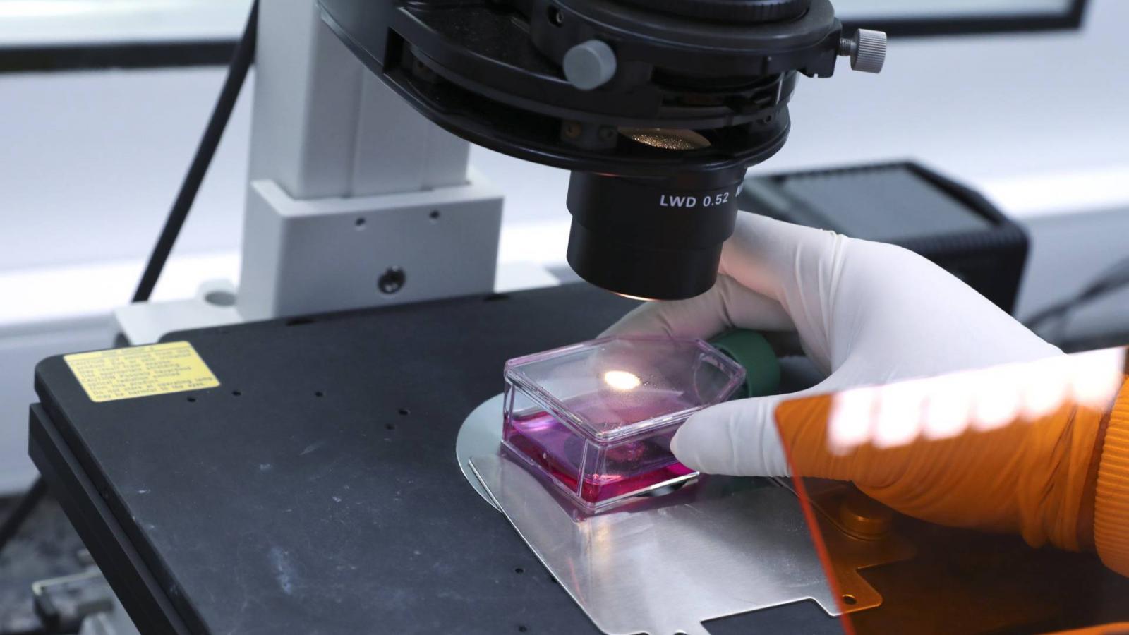 Képünk illusztráció