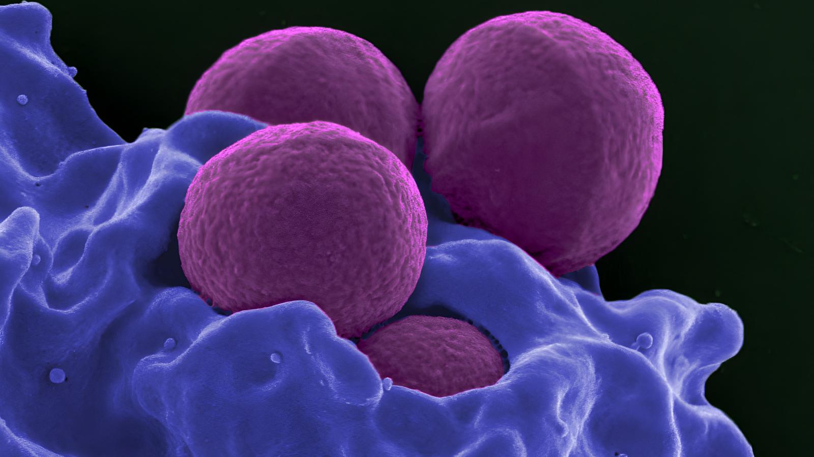 Egy multirezisztens baktérium, a staphylococcus aureus