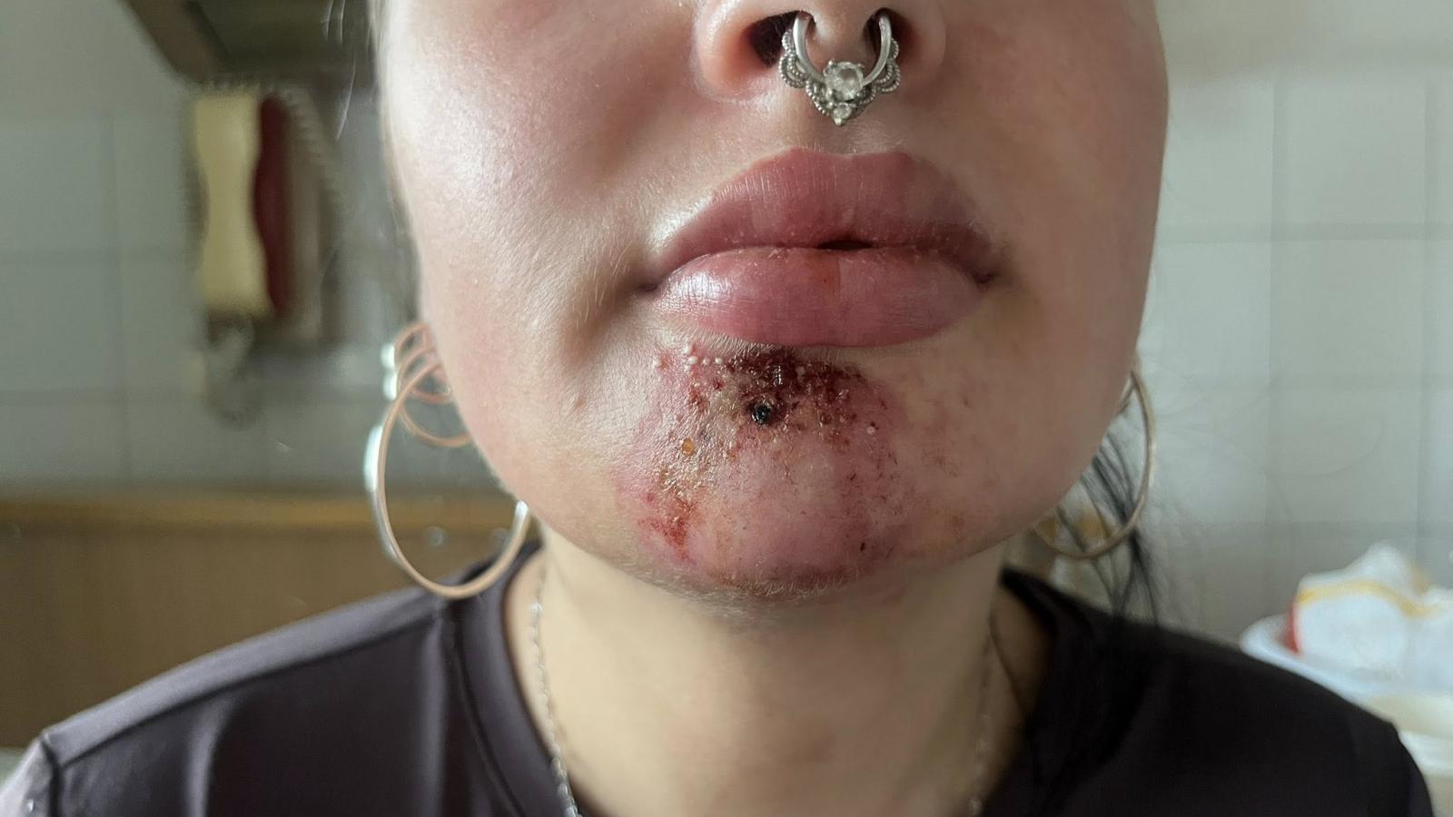 A nő állapota a kórházba kerüléskor