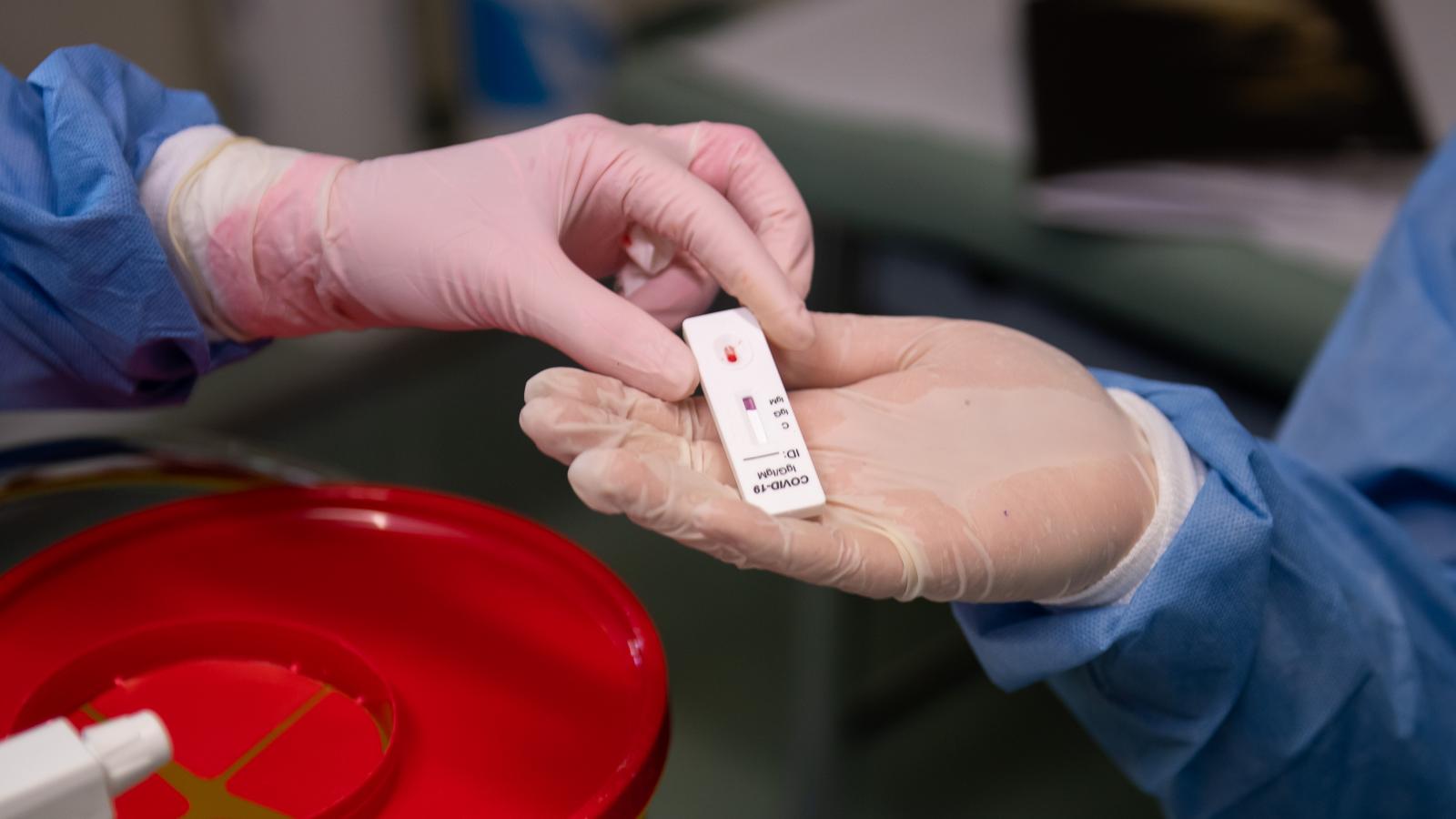 Teszt. Elkezdődött a nyár végi SARS–CoV–2-hullám