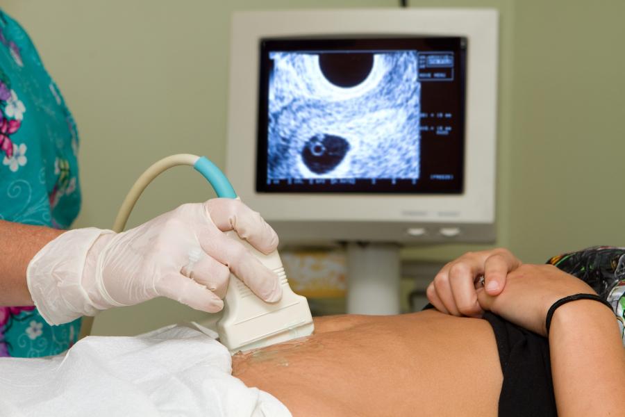 Kötelezővé tenné Dúró Dóra az abortusz előtti szívhang-hallgatást
