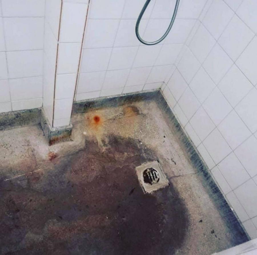 Sokkoló képet posztolt a kamara a Covid-centrum orvosi pihenőjéről és mosdójáról