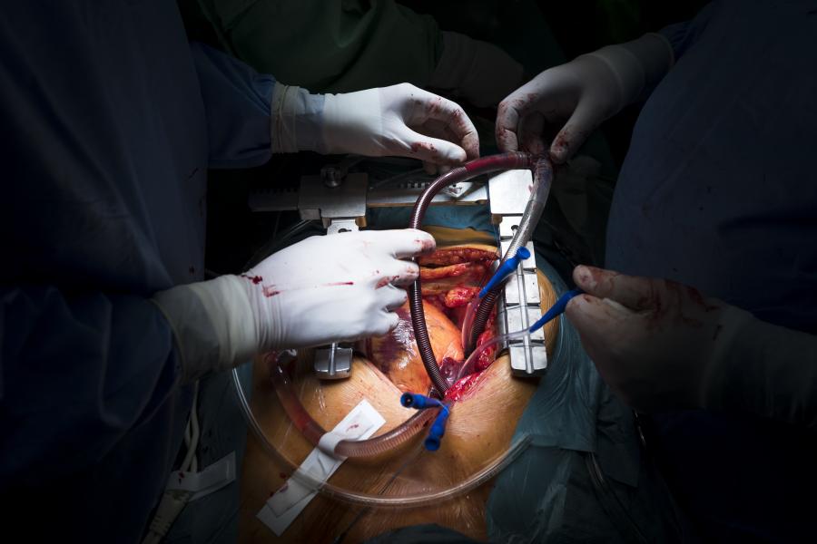 Erősen visszavetette a transzplantációkat a Covid-19 miatti bezárkózás