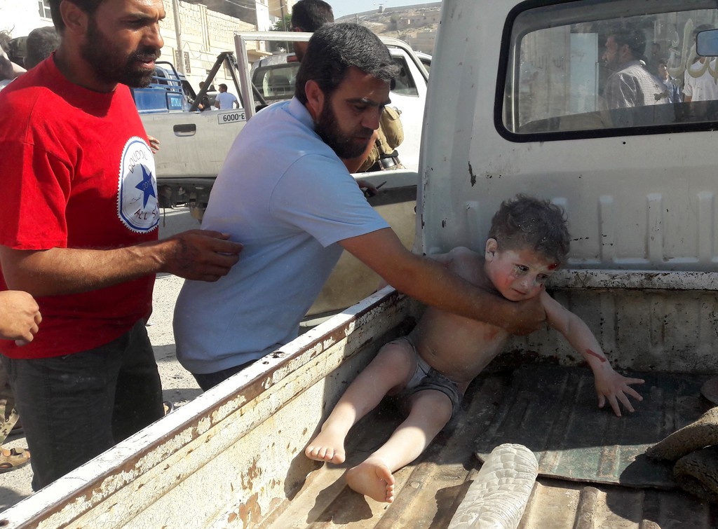 Sebesült gyerek Aleppóban - AFP fotó/BEHA EL HALEBI